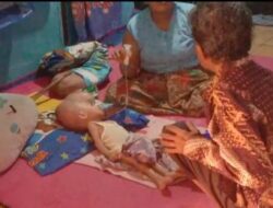 Balita Penderita Hydrocephalus di Kibin Butuh Perhatian Pemerintah