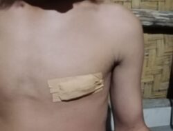 Miris..!! Murid Mts Ibnu Majah Diduga di Tusuk Oleh Adik Kelas, Pihak Sekolah Malah Tidak Lapor Kepada Pihak Yang Berwajib